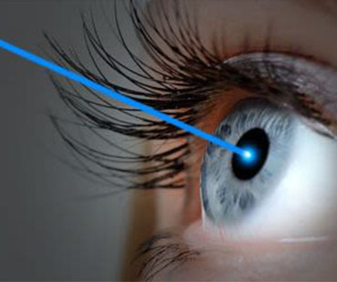 Refractive Surgery